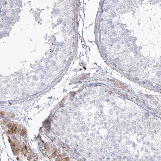 HYAL2 Antibody in Immunohistochemistry (IHC)