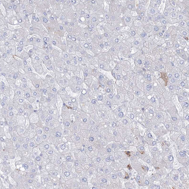 HYAL2 Antibody in Immunohistochemistry (IHC)