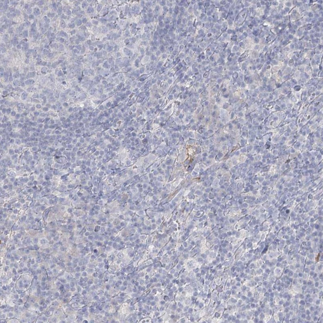 DMGDH Antibody in Immunohistochemistry (IHC)