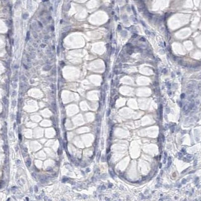 DMGDH Antibody in Immunohistochemistry (IHC)