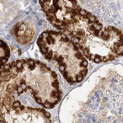 DMGDH Antibody in Immunohistochemistry (IHC)