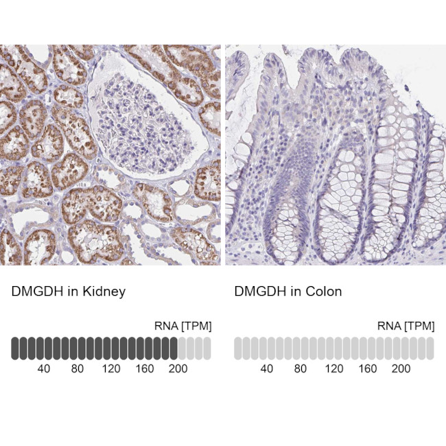 DMGDH Antibody in Immunohistochemistry (IHC)