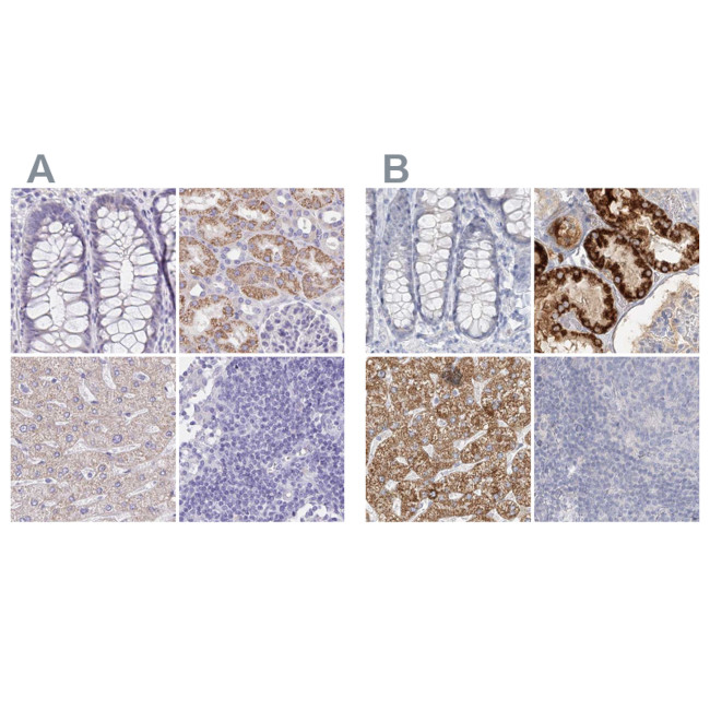 DMGDH Antibody in Immunohistochemistry (IHC)