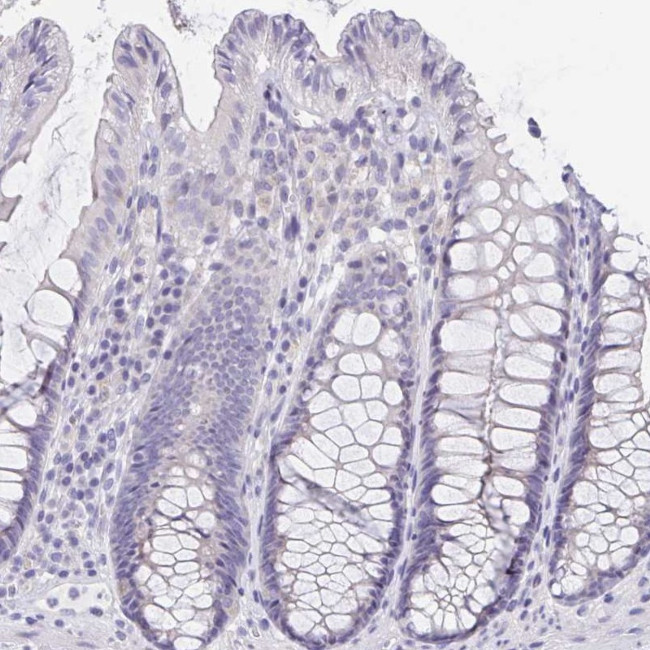 DMGDH Antibody in Immunohistochemistry (IHC)