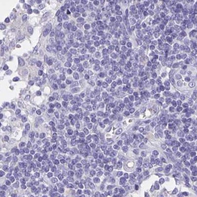 DMGDH Antibody in Immunohistochemistry (IHC)