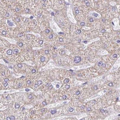 DMGDH Antibody in Immunohistochemistry (IHC)