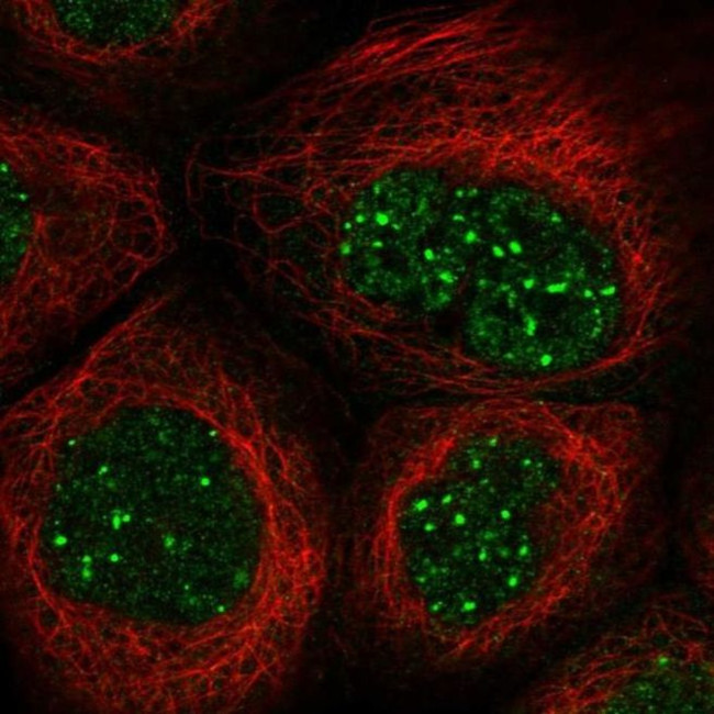 SAB Antibody in Immunocytochemistry (ICC/IF)