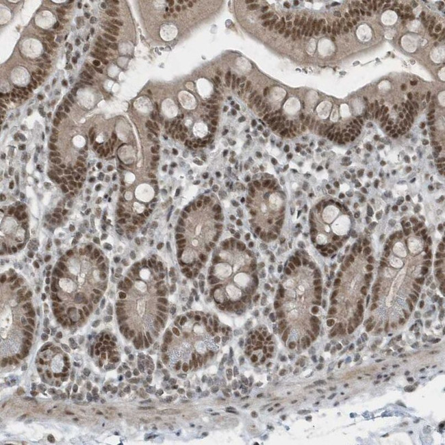 YTHDC1 Antibody in Immunohistochemistry (IHC)