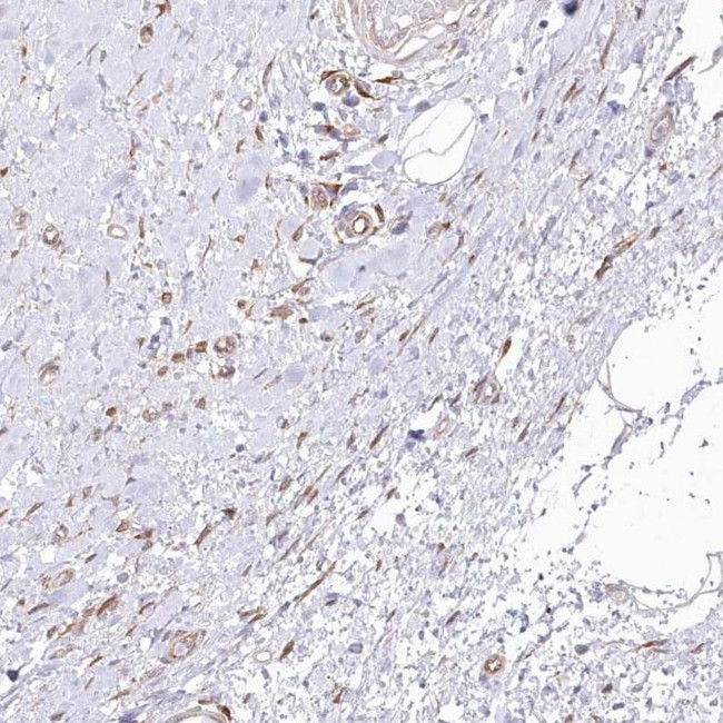 SH3PXD2B Antibody in Immunohistochemistry (IHC)