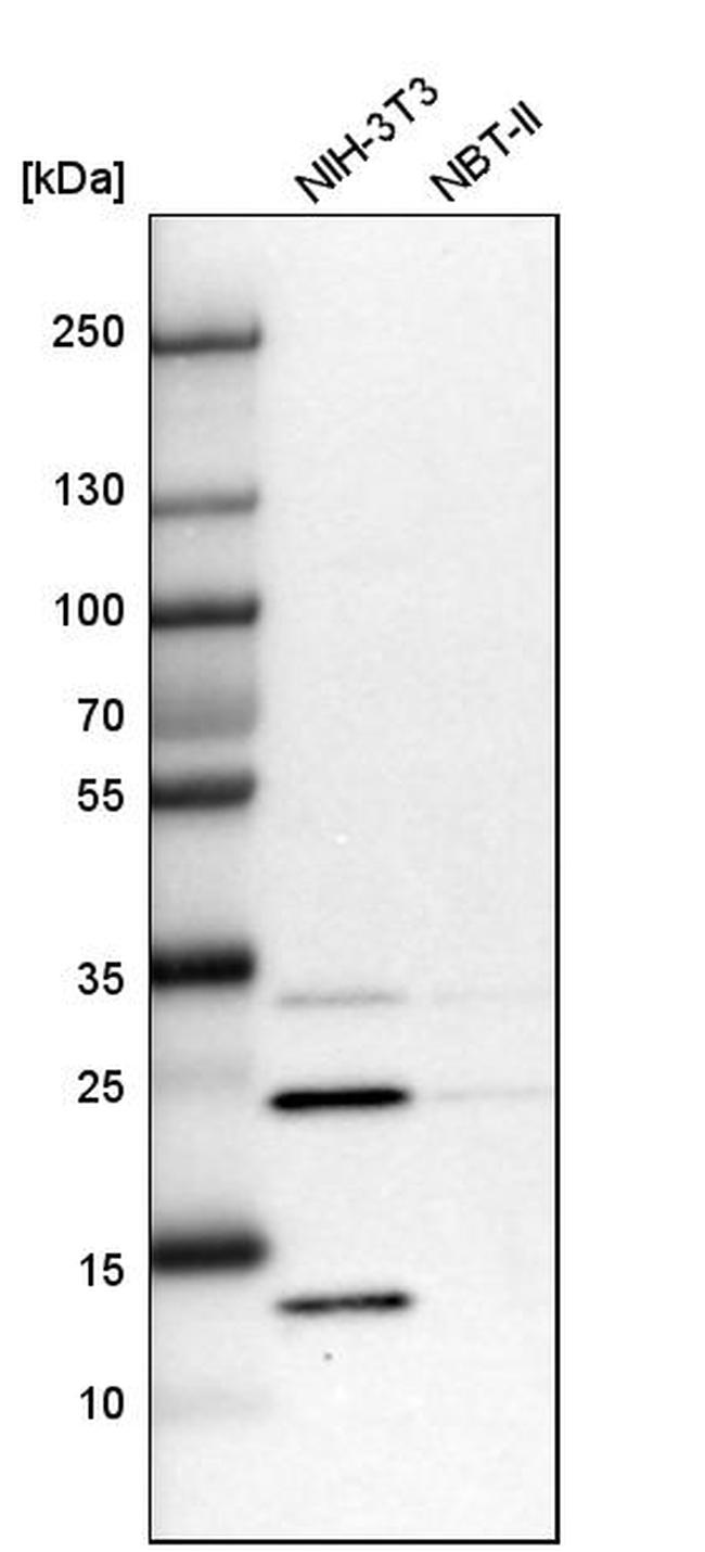 DCUN1D4 Antibody in Western Blot (WB)