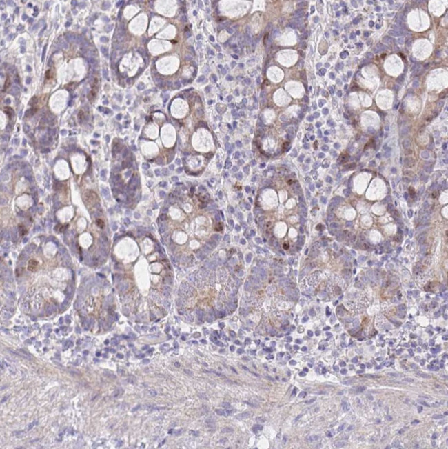 CENPH Antibody in Immunohistochemistry (IHC)