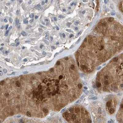 SCFD2 Antibody in Immunohistochemistry (IHC)