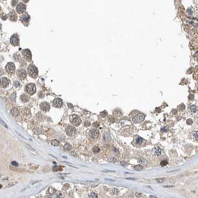 SCFD2 Antibody in Immunohistochemistry (IHC)