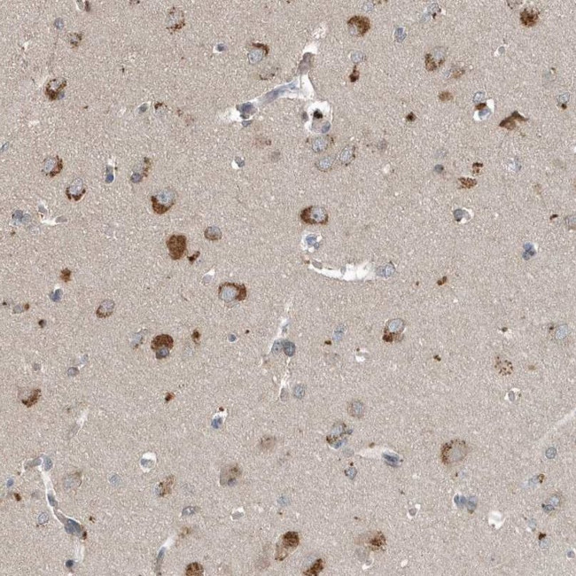 SCFD2 Antibody in Immunohistochemistry (IHC)