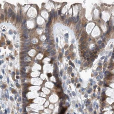 SCFD2 Antibody in Immunohistochemistry (IHC)