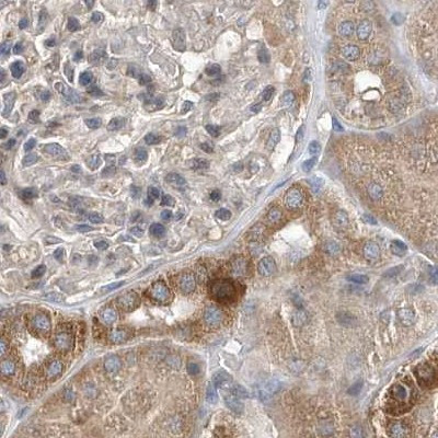 SCFD2 Antibody in Immunohistochemistry (IHC)