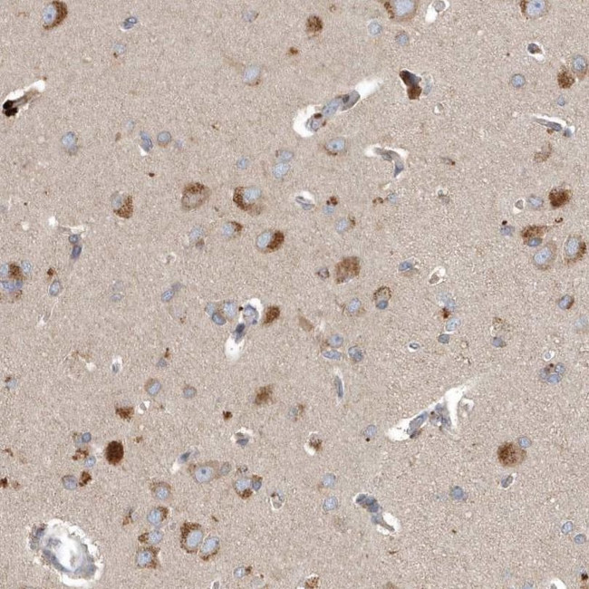 SCFD2 Antibody in Immunohistochemistry (IHC)