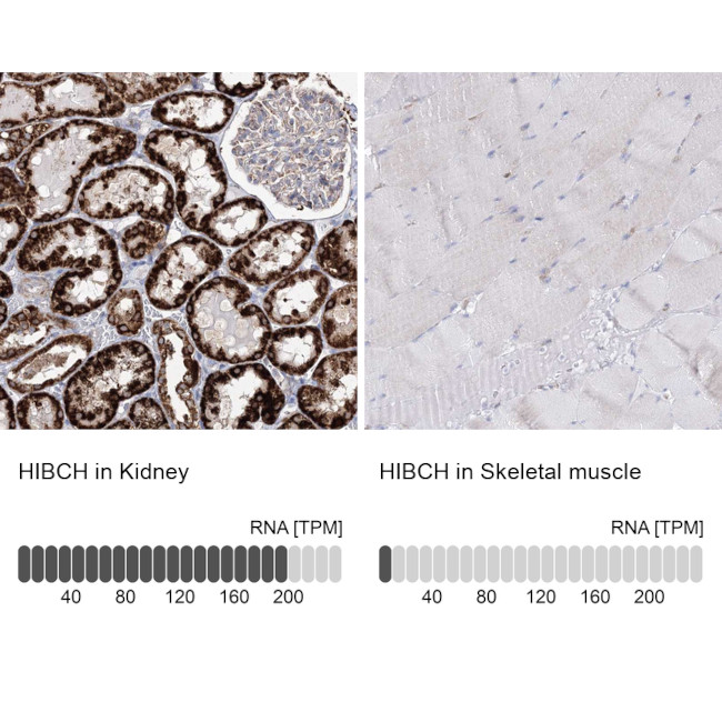 HIBCH Antibody in Immunohistochemistry (IHC)