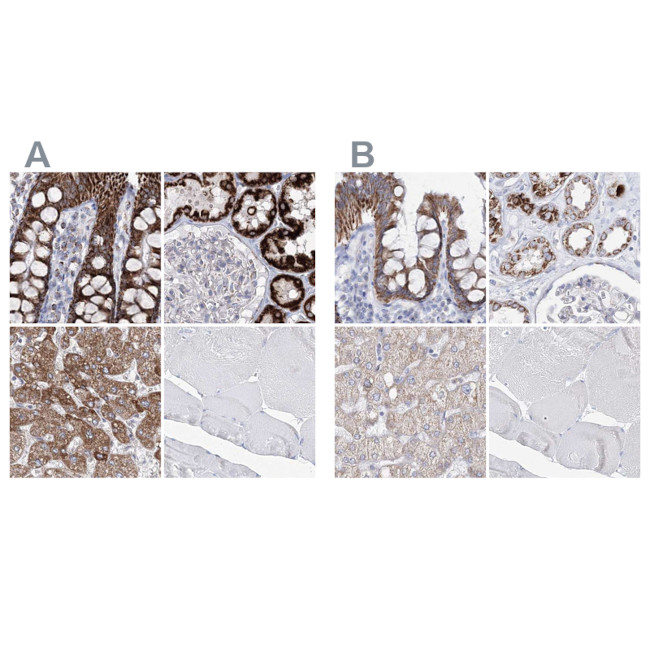 HIBCH Antibody in Immunohistochemistry (IHC)