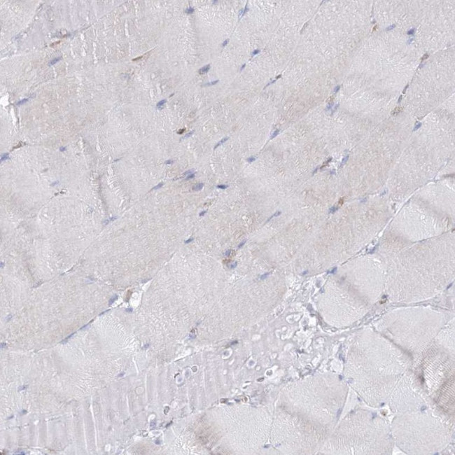 HIBCH Antibody in Immunohistochemistry (IHC)