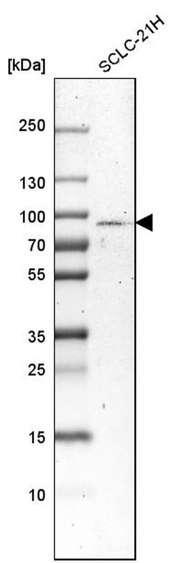 SCLT1 Antibody in Western Blot (WB)