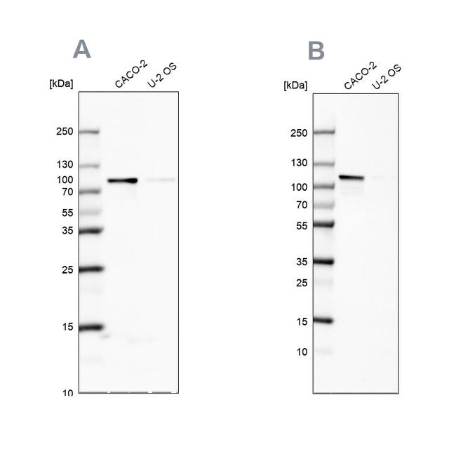 LAR4B Antibody in Western Blot (WB)