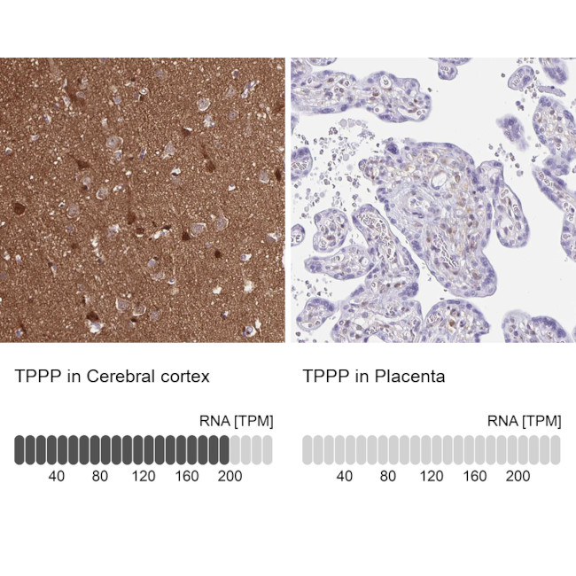 TPPP Antibody in Immunohistochemistry (IHC)