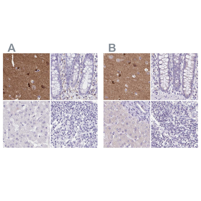 TPPP Antibody in Immunohistochemistry (IHC)