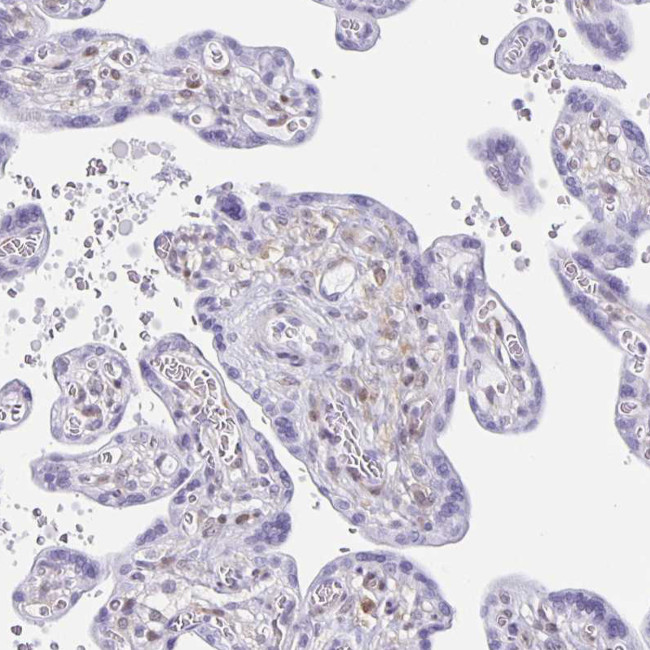 TPPP Antibody in Immunohistochemistry (IHC)