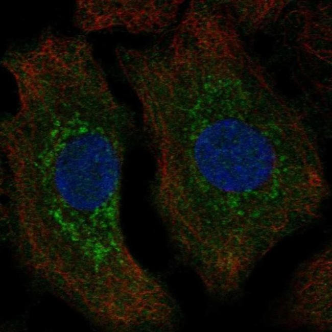 TPPP Antibody in Immunocytochemistry (ICC/IF)