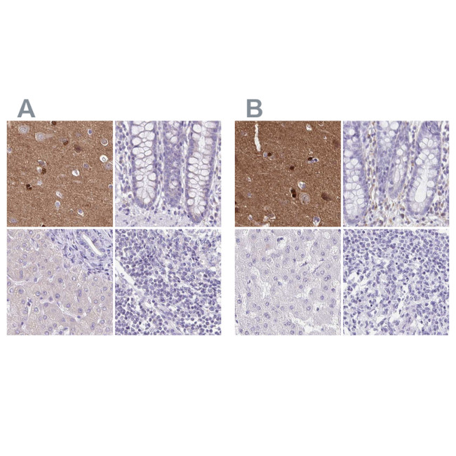 TPPP Antibody in Immunohistochemistry (IHC)