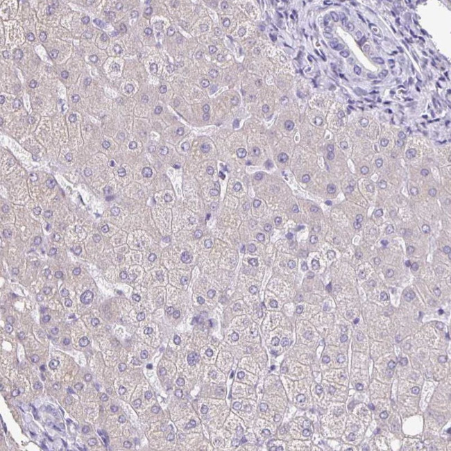 TPPP Antibody in Immunohistochemistry (IHC)