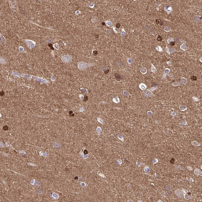 TPPP Antibody in Immunohistochemistry (IHC)