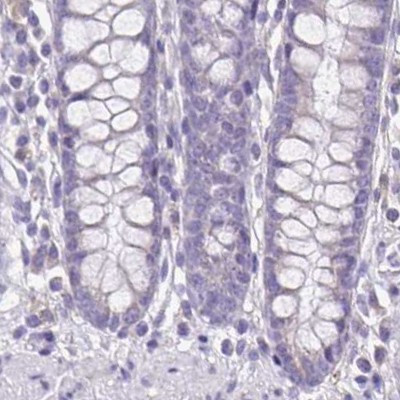 TPPP Antibody in Immunohistochemistry (IHC)