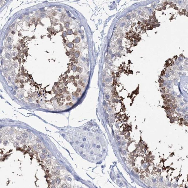 DPCD Antibody in Immunohistochemistry (IHC)