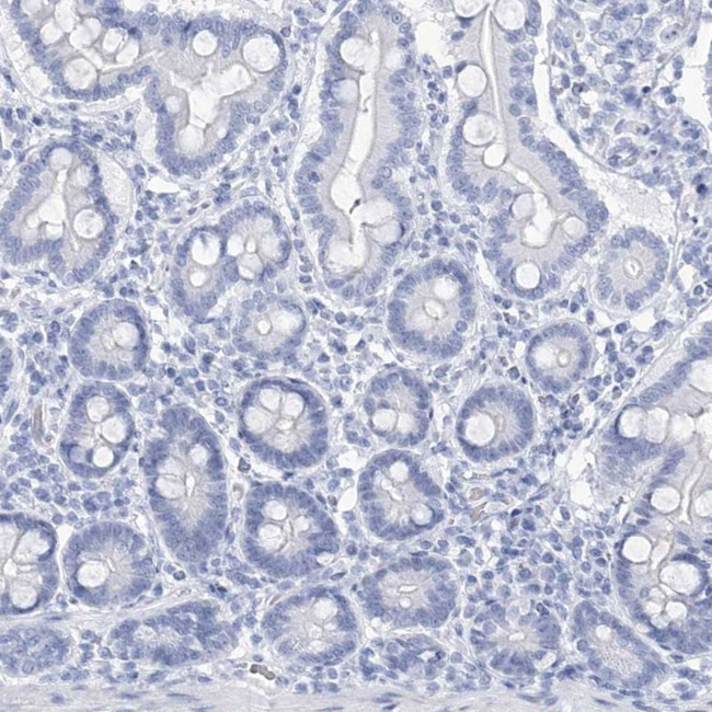 DPCD Antibody in Immunohistochemistry (IHC)