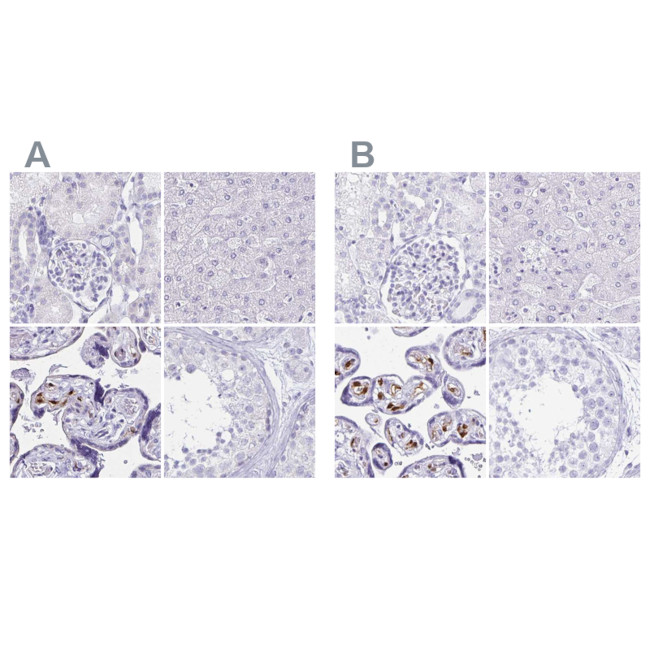 LIN28B Antibody in Immunohistochemistry (IHC)