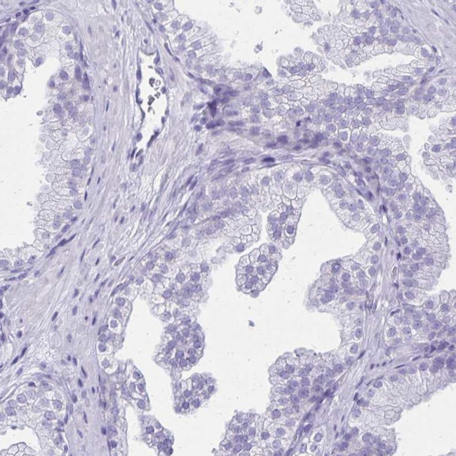 LIN28B Antibody in Immunohistochemistry (IHC)