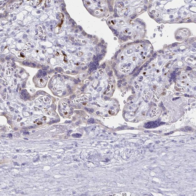 LIN28B Antibody in Immunohistochemistry (IHC)