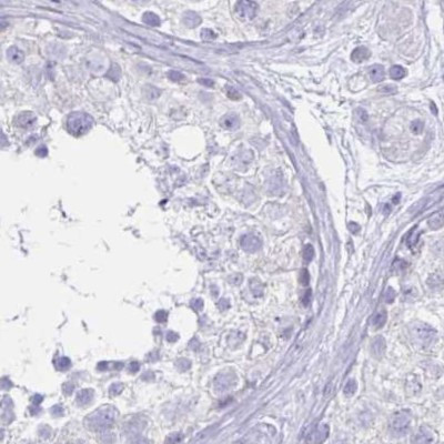 LIN28B Antibody in Immunohistochemistry (IHC)