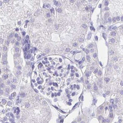 LIN28B Antibody in Immunohistochemistry (IHC)