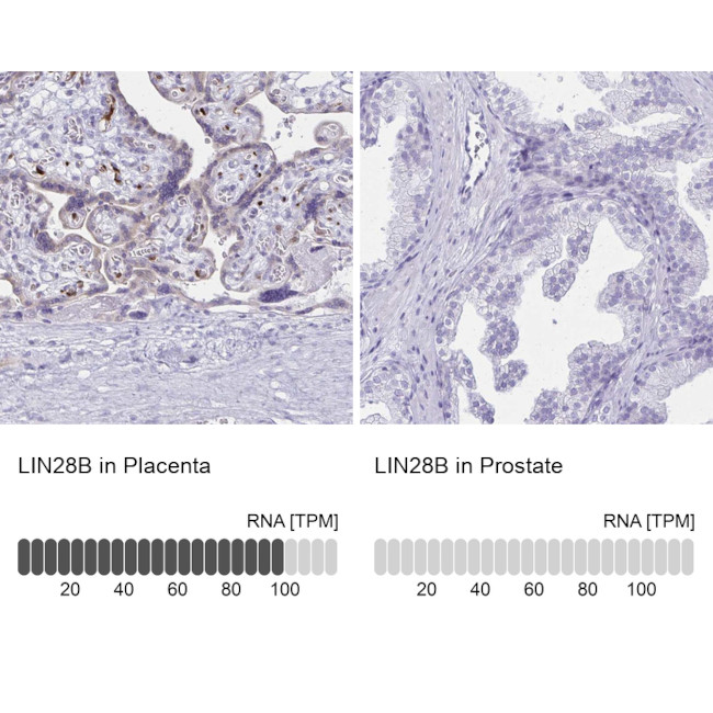 LIN28B Antibody