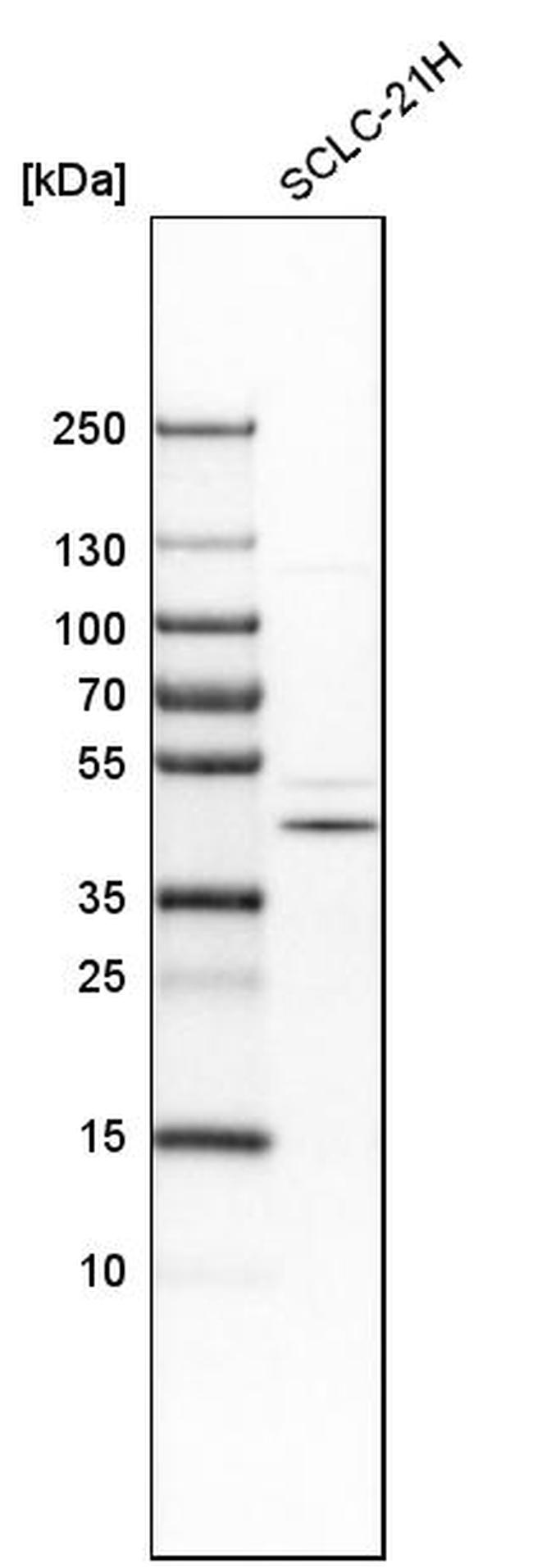 RG9MTD1 Antibody in Western Blot (WB)