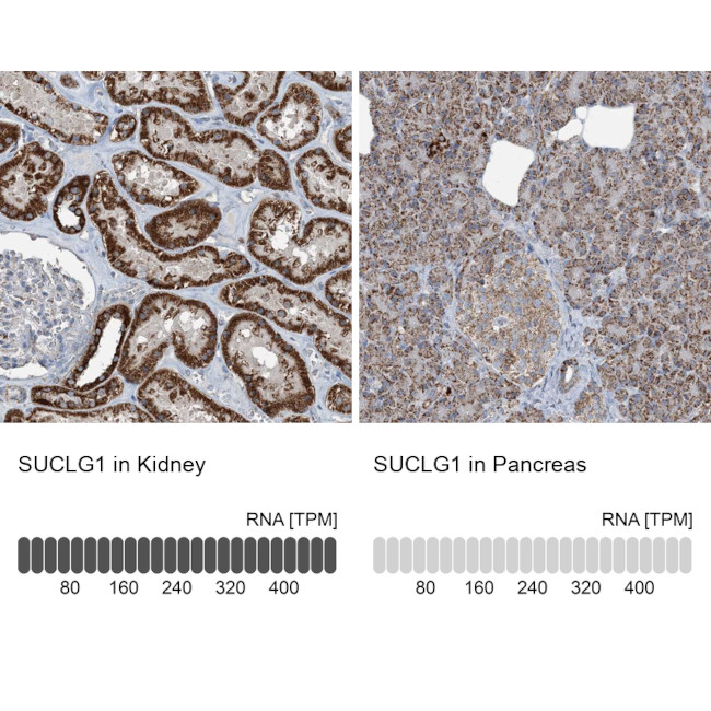 SUCLG1 Antibody in Immunohistochemistry (IHC)