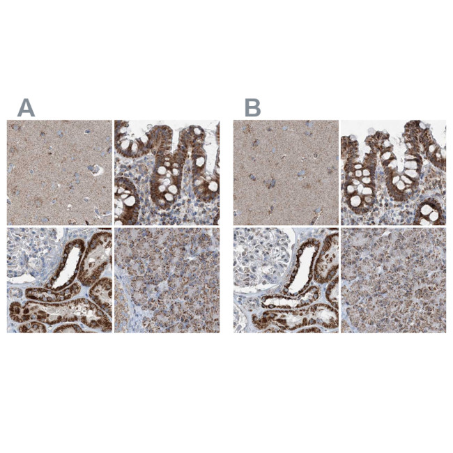 SUCLG1 Antibody in Immunohistochemistry (IHC)