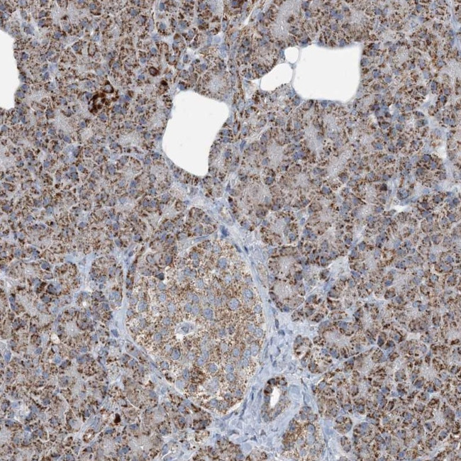 SUCLG1 Antibody in Immunohistochemistry (IHC)