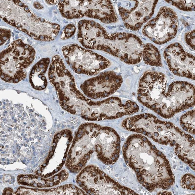 SUCLG1 Antibody in Immunohistochemistry (IHC)