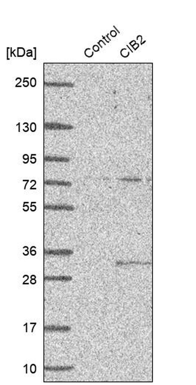 KIP2 Antibody in Western Blot (WB)