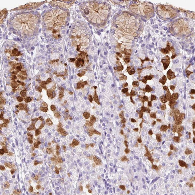 TFF2 Antibody in Immunohistochemistry (IHC)