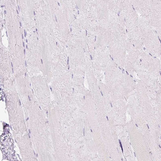 TFF2 Antibody in Immunohistochemistry (IHC)